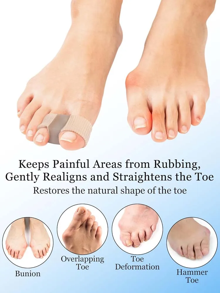 Toe Separators 2-Pack – Bunion Relief & Toe Spacers for Daily Wear - alternate view