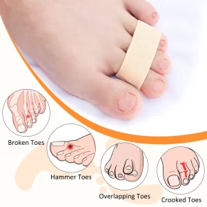 Hammer Toe Straighteners 2-Pack – Toe Splints for Bent & Overlapping Toes