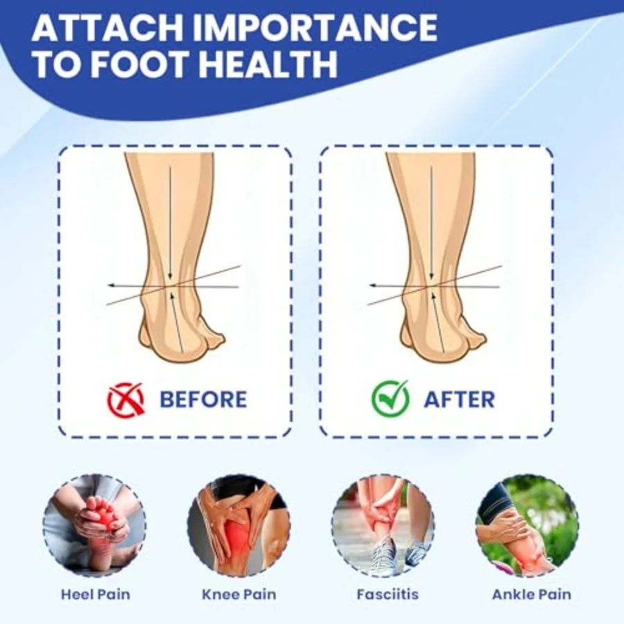 Arch Support Shoe Inserts – Orthotic Insoles for Flat Feet - color options