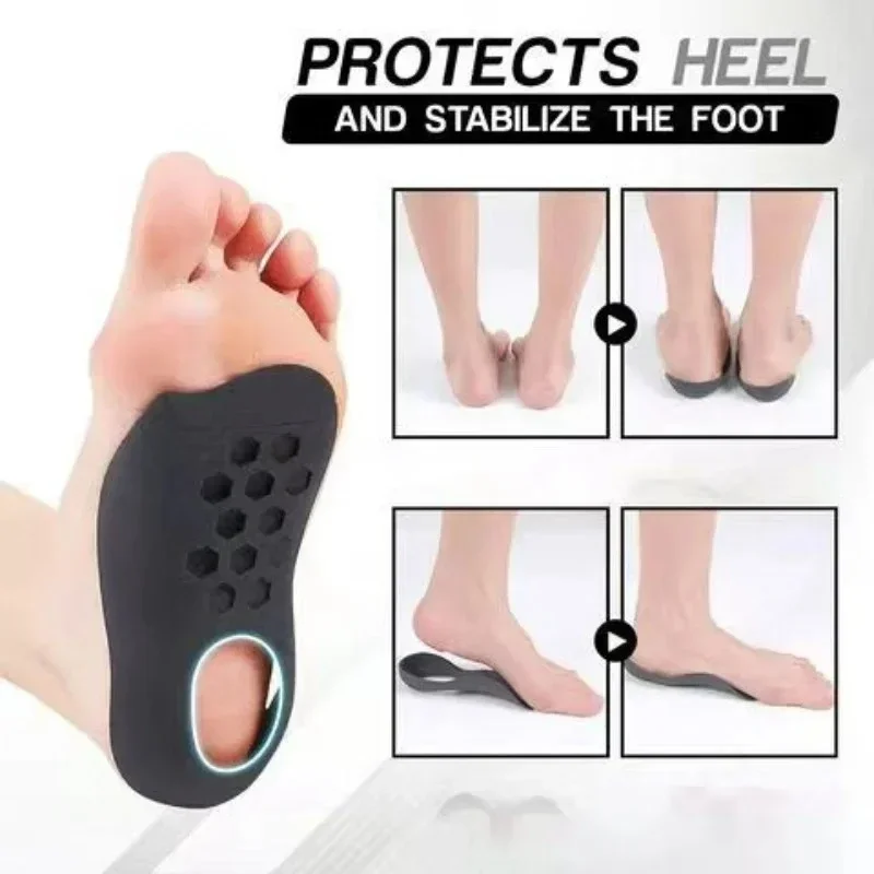 Orthotic Insoles for Flat Feet – XO-Leg Correction Arch Supports - close-up detail